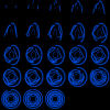 ani006